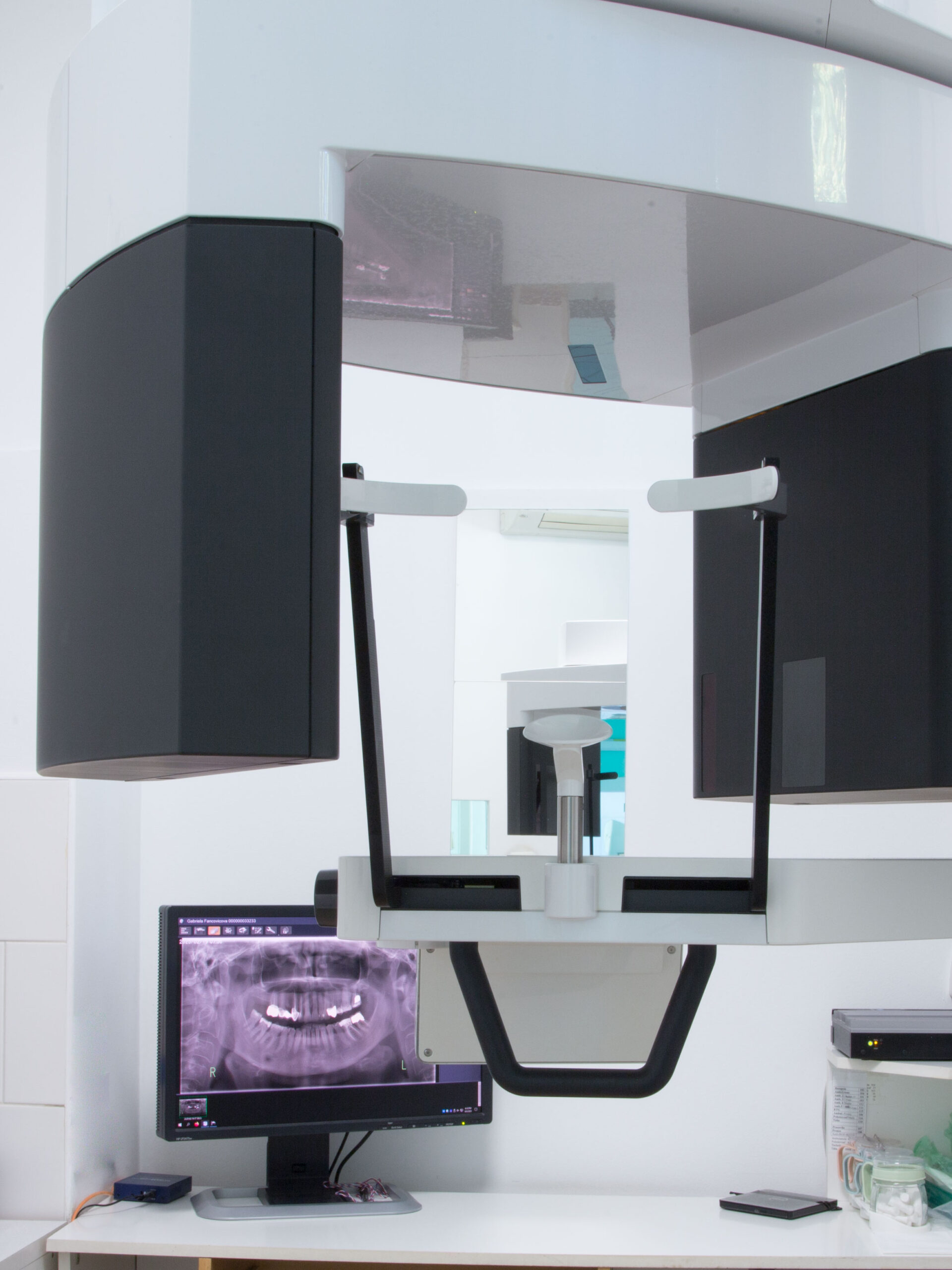 CBCT/ panoramatický RTG